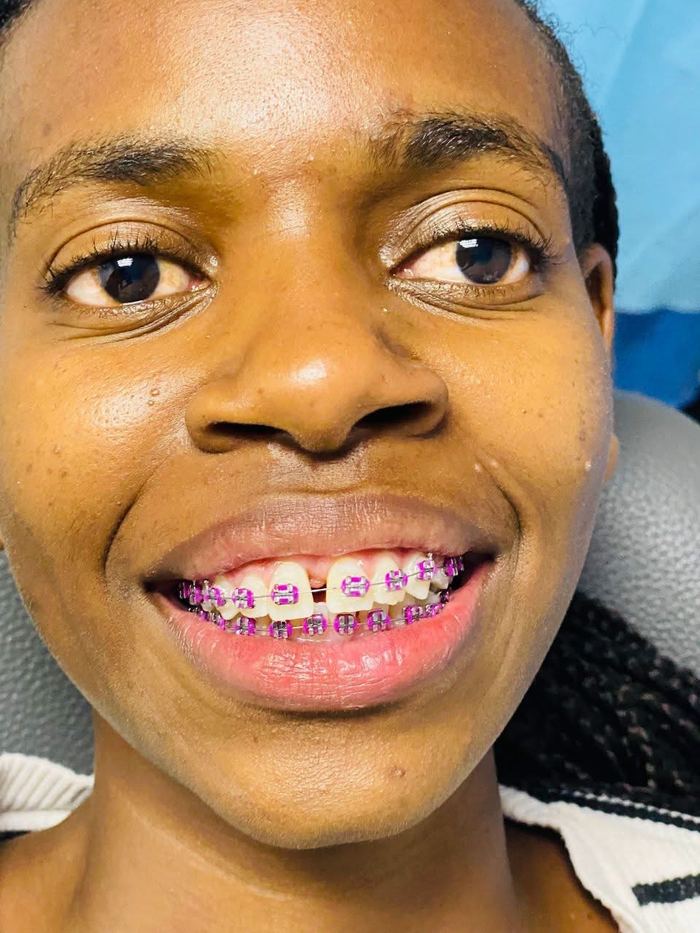 Happy patient